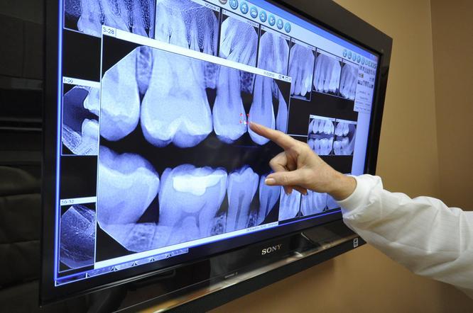 Dental x-rays with our Arvada Dentist at AFC Arvada Family and Cosmetic Dentistry