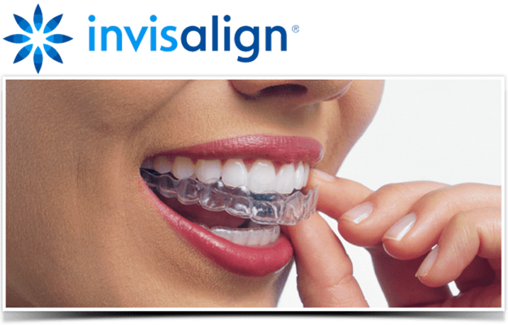 Invisalign by Arvada Dentist at AFC Arvada Family and Cosmetic Dentistry